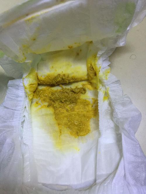 喝母乳,这样的大便有好几天了,新生儿12天