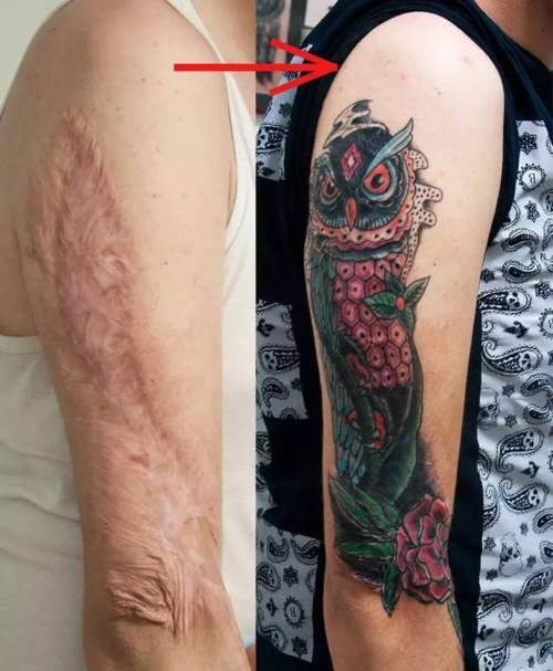 在伤疤上的纹身确实很美,但在遮盖前首先要知道这几点!