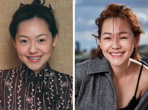 绝对干货还送福利|女明星不一定整容,但整牙是千真万确的