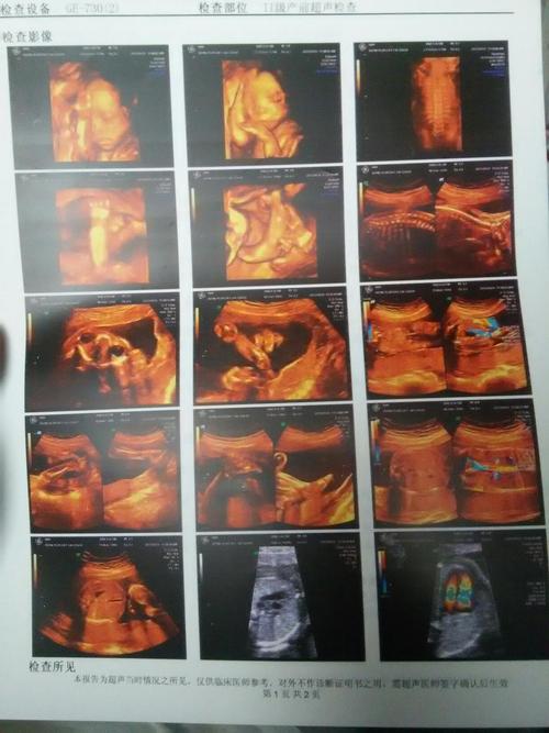 宝妈们看看这四维像男宝还是女宝_百度宝宝知道