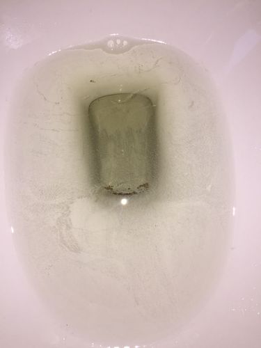 早上起来的晨尿 泡泡很多 消散速度很慢