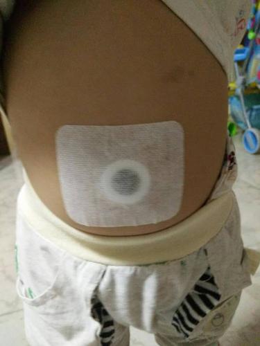 药丸对准孩子的肚脐眼(神阙穴)贴上,用胶布固定好,保持12个小时以上,1
