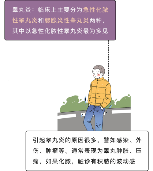 蛋蛋的一万种死法看完疼哭了哈哈哈哈