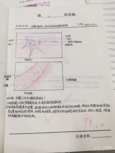 神经元中动脉光镜结构图