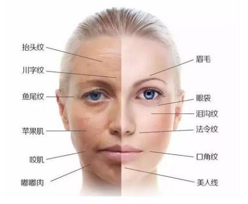 你搞清楚你脸上的皱纹属于哪种皱纹吗?
