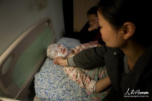 武汉:走路鞋子拖地发出噪声 13岁女孩遭邻居泼硫酸毁容