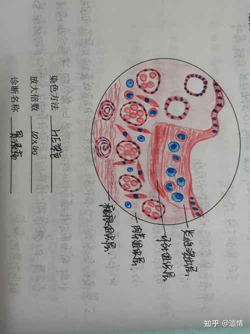 病理学组织切片红蓝铅手绘图
