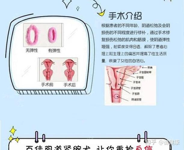 湿邪,如果不做满月发汗的话,会有产后头痛,腰背痛,全身关节痛的后遗症