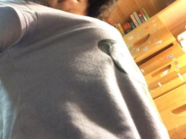 四年级女孩,胸这么大正常吗?