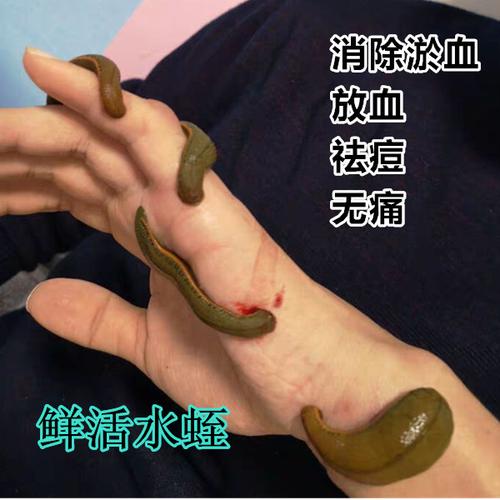 荣郁吸血水蛭活物广东菲牛水蛭金线宽体吸淤血消肿蚂蟥活体15g包活25