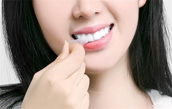 牙贴可以美白牙齿吗