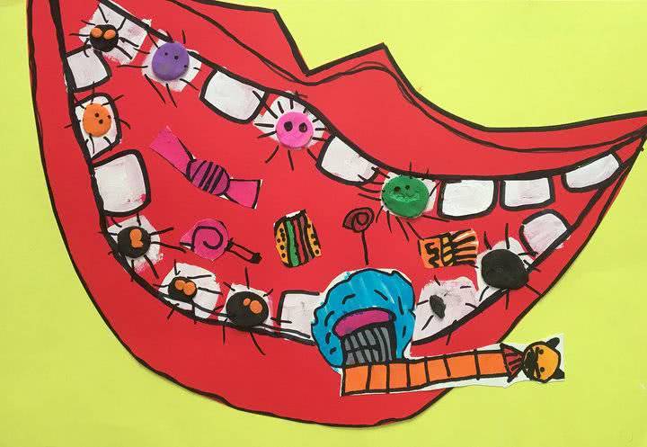 创意爱牙小卫士2名