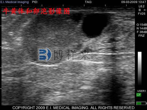 牛用b超兽用b超观察牛卵泡发育的过程