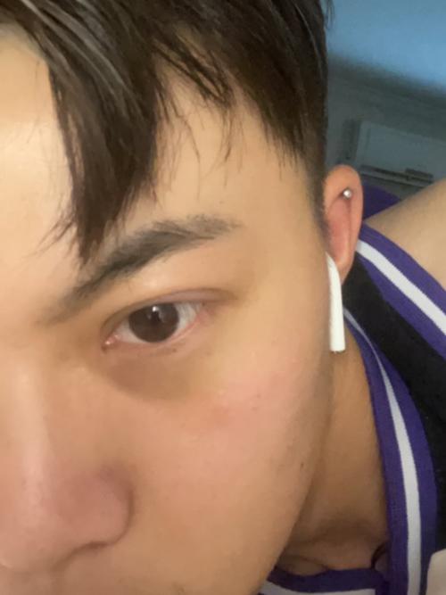 男士双眼皮 【双眼皮】第八天第九天