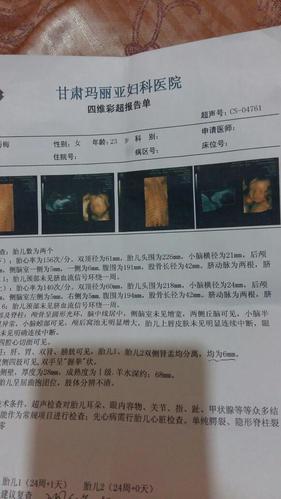 双宝四维出来了 估计是两男宝