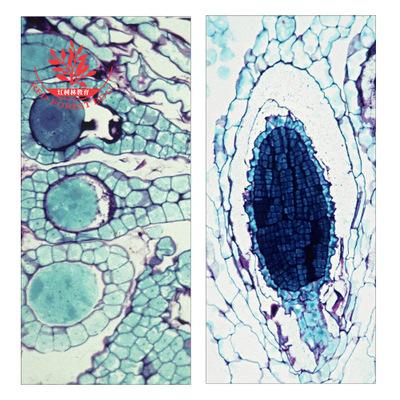 教学标本结构清晰地钱系列切片标本地钱精子器地钱颈卵器生物切片