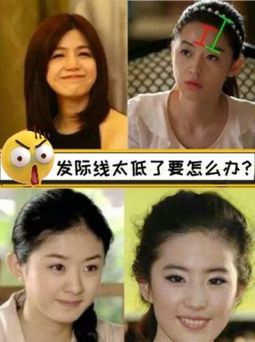 发际线太低了要怎么办?
