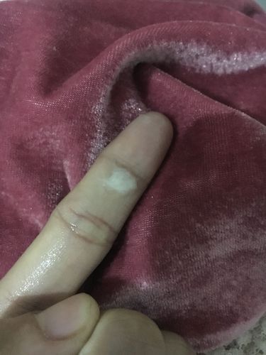 这种是什么白带