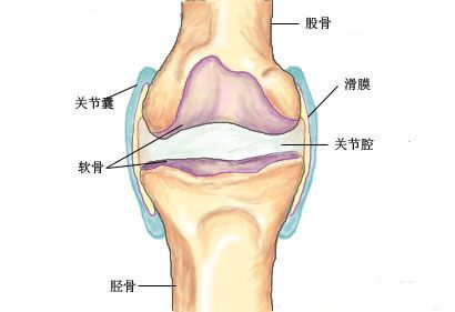 膝关节慢性滑膜炎