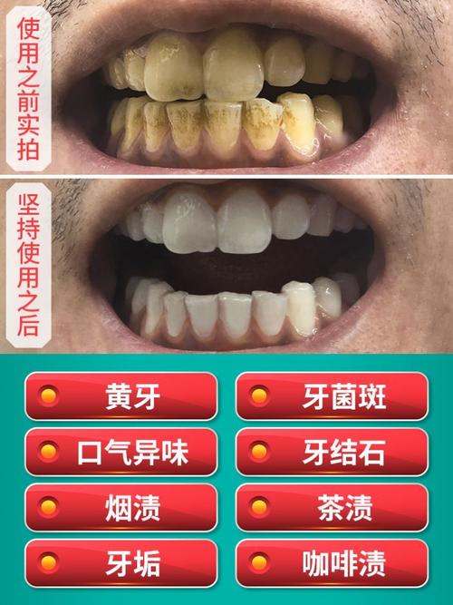 官网哈贝斯洁牙素牙粉美白葵璞速白素堂牙洁牙粉