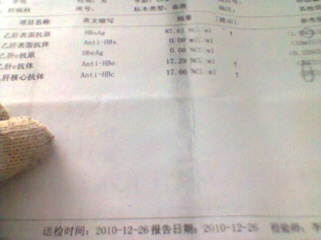 乙肝两对半化验结果有什么不同?