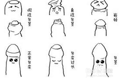 包茎了,怎么办
