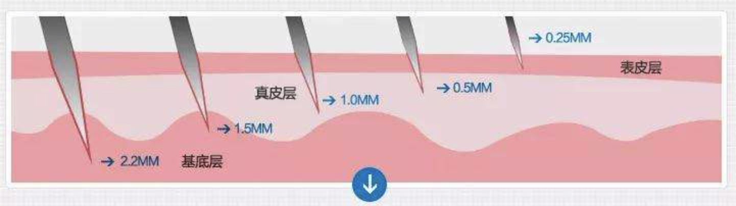 一篇读懂什么是微针