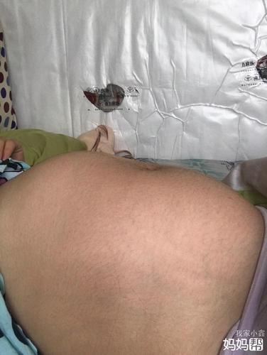 34周 4天,肚子拱到哪儿了,宝宝这是在干啥呢