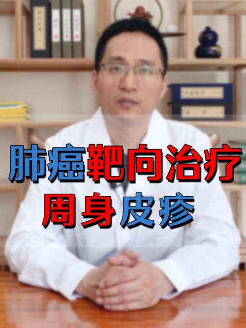 肺癌靶向治疗,导致周身皮疹!