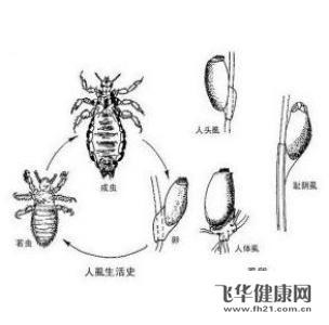 阴虱病是由于寄生在我们人体阴毛和和体毛上的阴虱叮咬我们的
