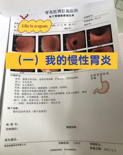 (一)我的慢性浅表性胃炎幽门螺杆菌_胃炎_腹泻_中药_异物感_食道炎