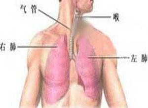 慢性支气管炎患者在x线检查中可见两下肺纹理增粗,慢性支气管炎