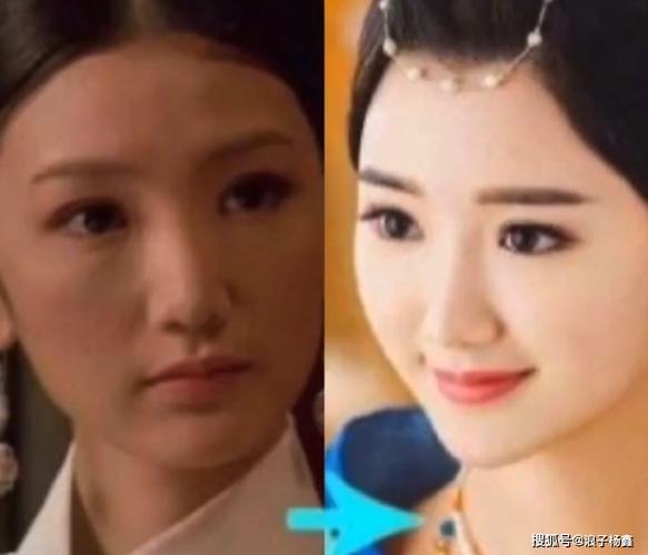 原创毛晓彤整容前后对比照出炉,网友:整容前像村姑!