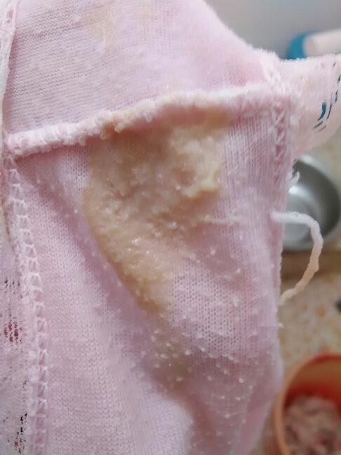 白带腥臭,是什么回事