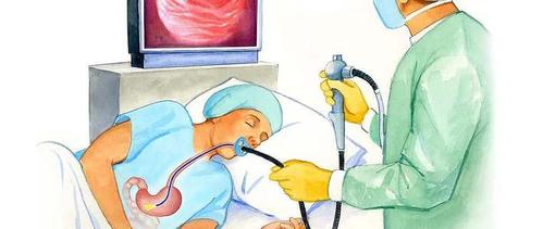              一个人做胃镜是什么