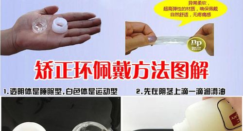 日本npg joker包皮环假性包茎纠正器包皮阻复环延时阻