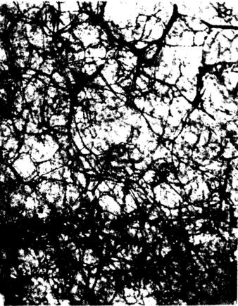 真皮下血管网皮瓣血循环途径的实验研究