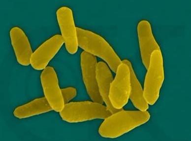 白喉病自己能好吗 白喉的食疗方法