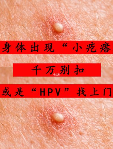 "那个地方"长小疙瘩,是hpv找上门_hpv_免疫力_男朋友