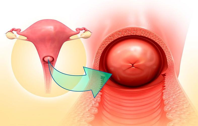 宫颈肥大就要做leep刀吗你可别吓我