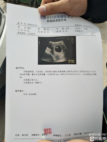 孕囊这么圆没见过这么圆的不知道是男宝