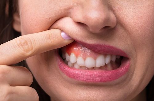 牙龈发炎肿痛,该怎么办?口腔医生和你聊聊