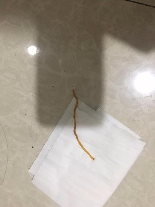 提问大便拉出一条细长黄色的不知道是不是虫子的软的东西,请问这个是