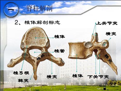 一 脊柱解剖 上关节突 横突 2,椎体解剖标志 椎体 椎管 椎弓根 棘突