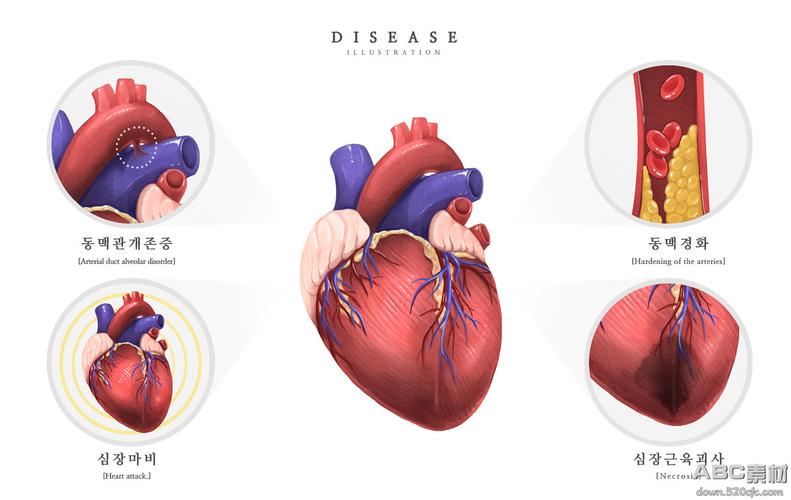 医院肌肉心脏动脉静脉研究医学疾病器官插画素材