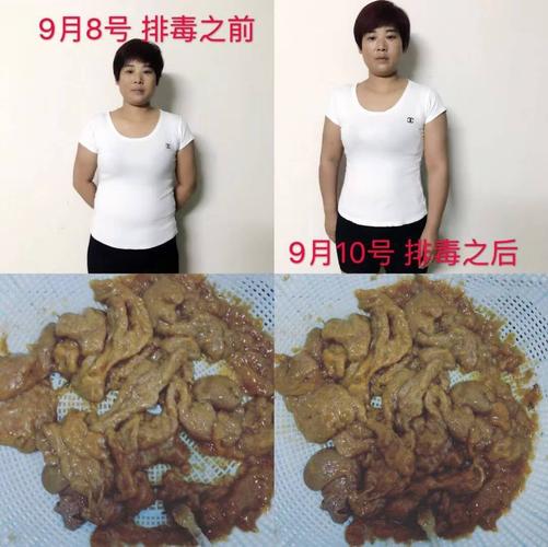 用藤黄果排出来的肠道毒素三天见效果的,我们一定要排出肠道毒素.