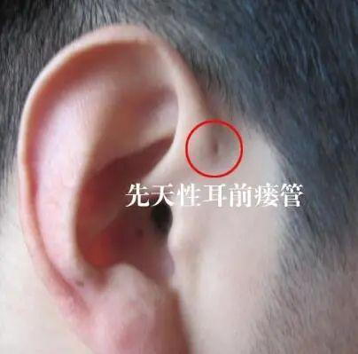 hallo科普君前仓藏粮,后仓藏糠,耳朵棱上藏衣裳,有耳仓的人有福气?