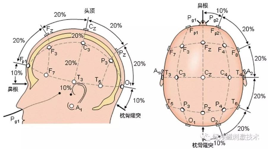 七台河精神卫生中心经颅磁刺激技术简介
