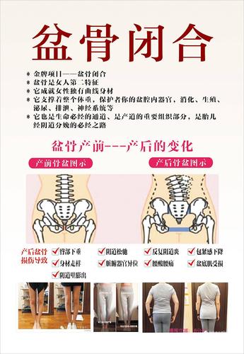 盆骨闭合的10大优势