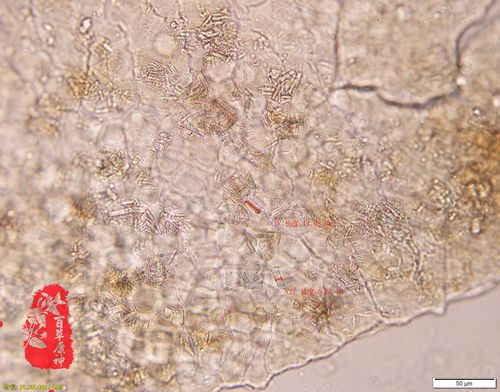 黑芝麻草酸钙柱晶↑黑芝麻偏光镜下草酸钙结晶↑黑芝麻草酸钙结晶